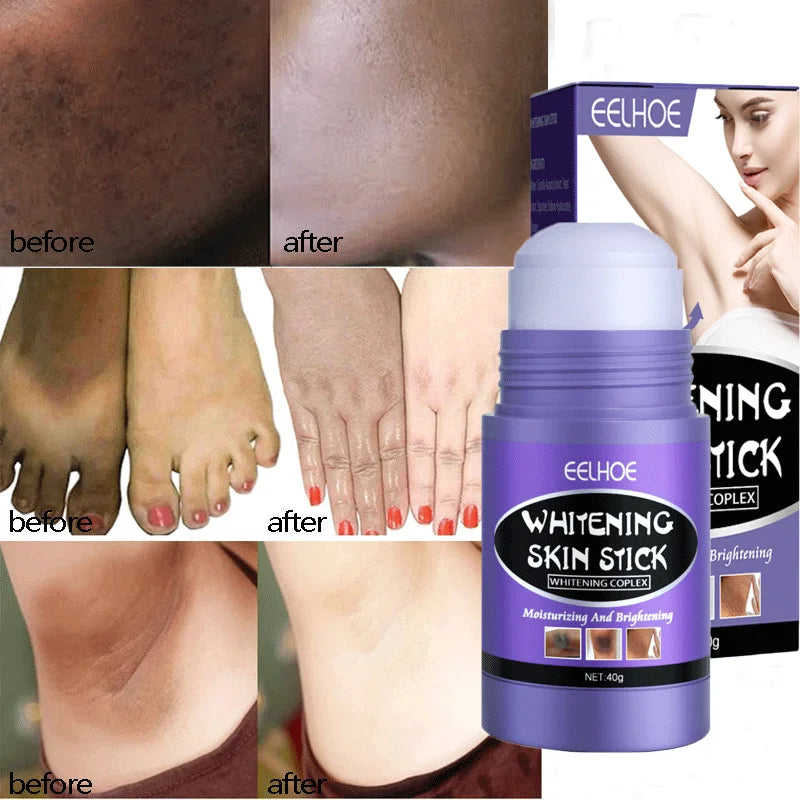 Armpit Whitening Cream Private Parts Dark Skin