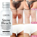 Whitening Cream Private Parts Underarm