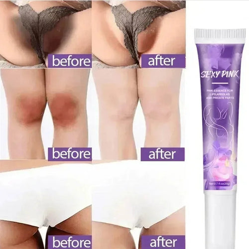 Whitening Cream Private Parts Underarm
