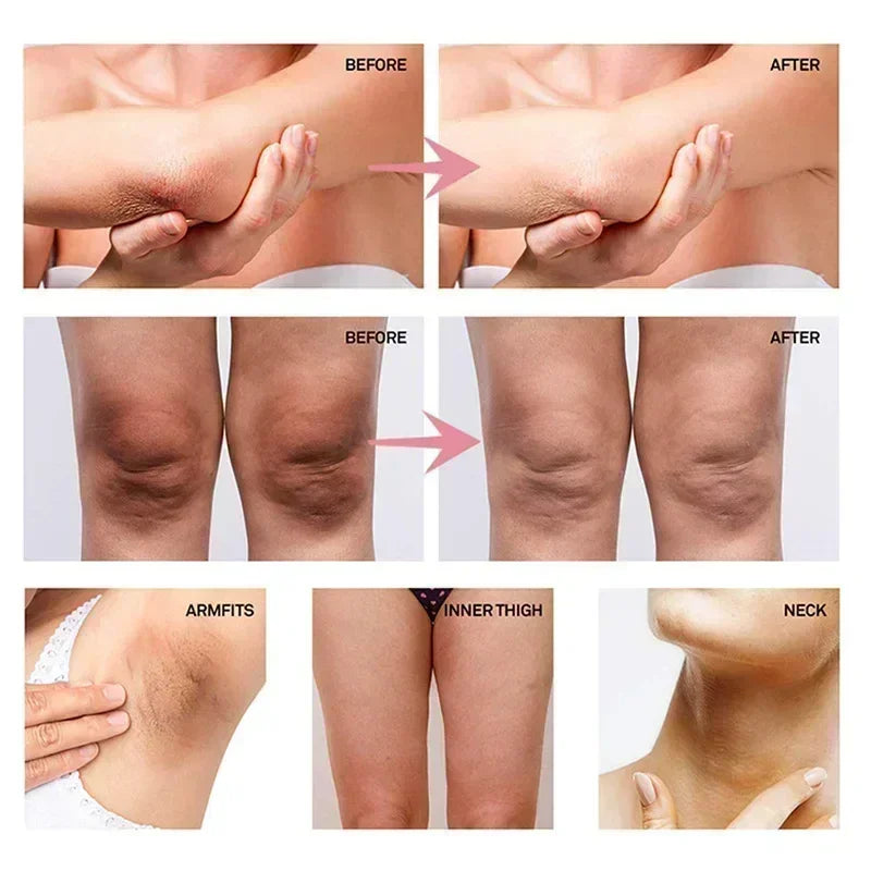 Whitening Cream Private Parts Underarm