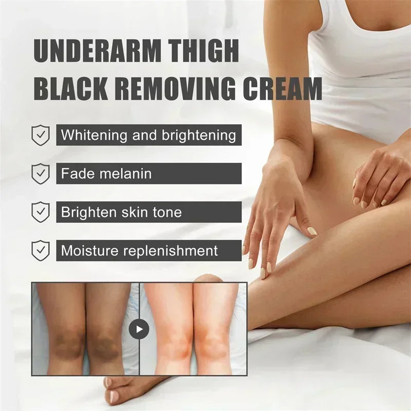 Whitening Cream
